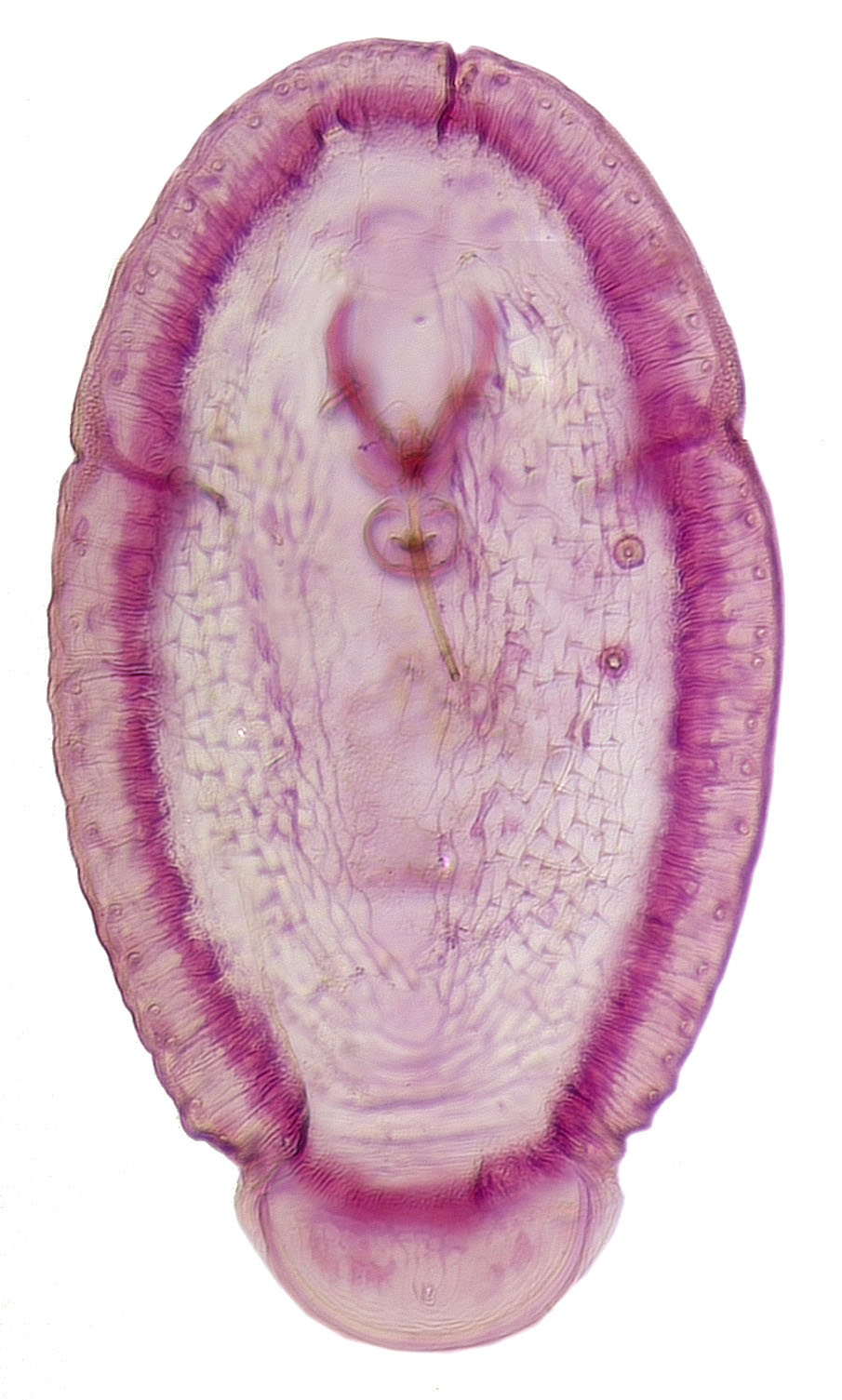  Halimococcidae:  Thysanococcus pandani  
 Second Instar Female 